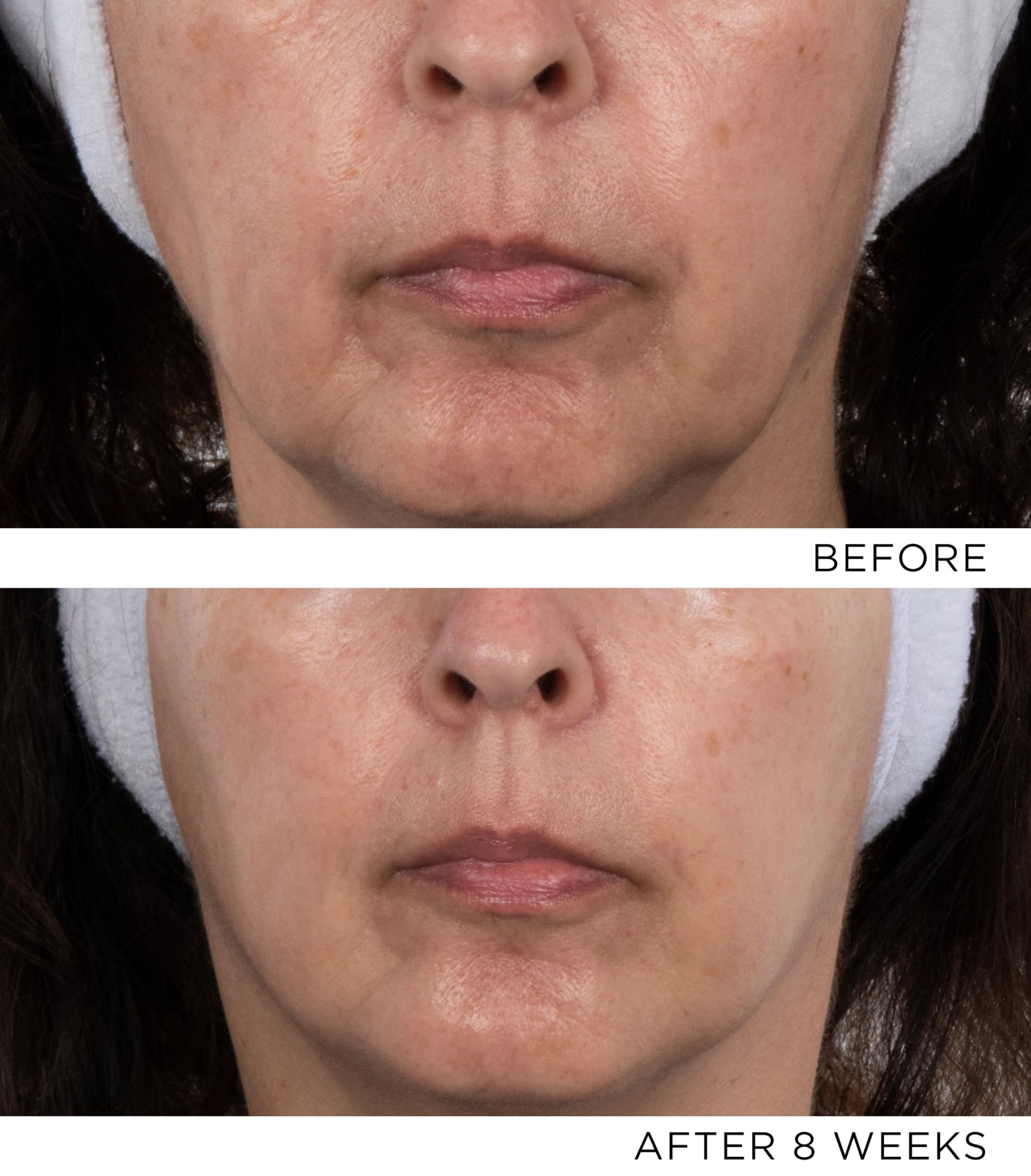 Noble Panacea, The Exceptional Chronobiology Sleep Mask 8 dose