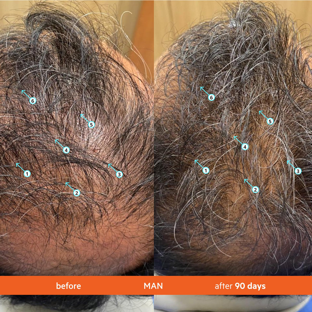 Hair Growth Shampoo & Conditioner Set for Thinning Hair