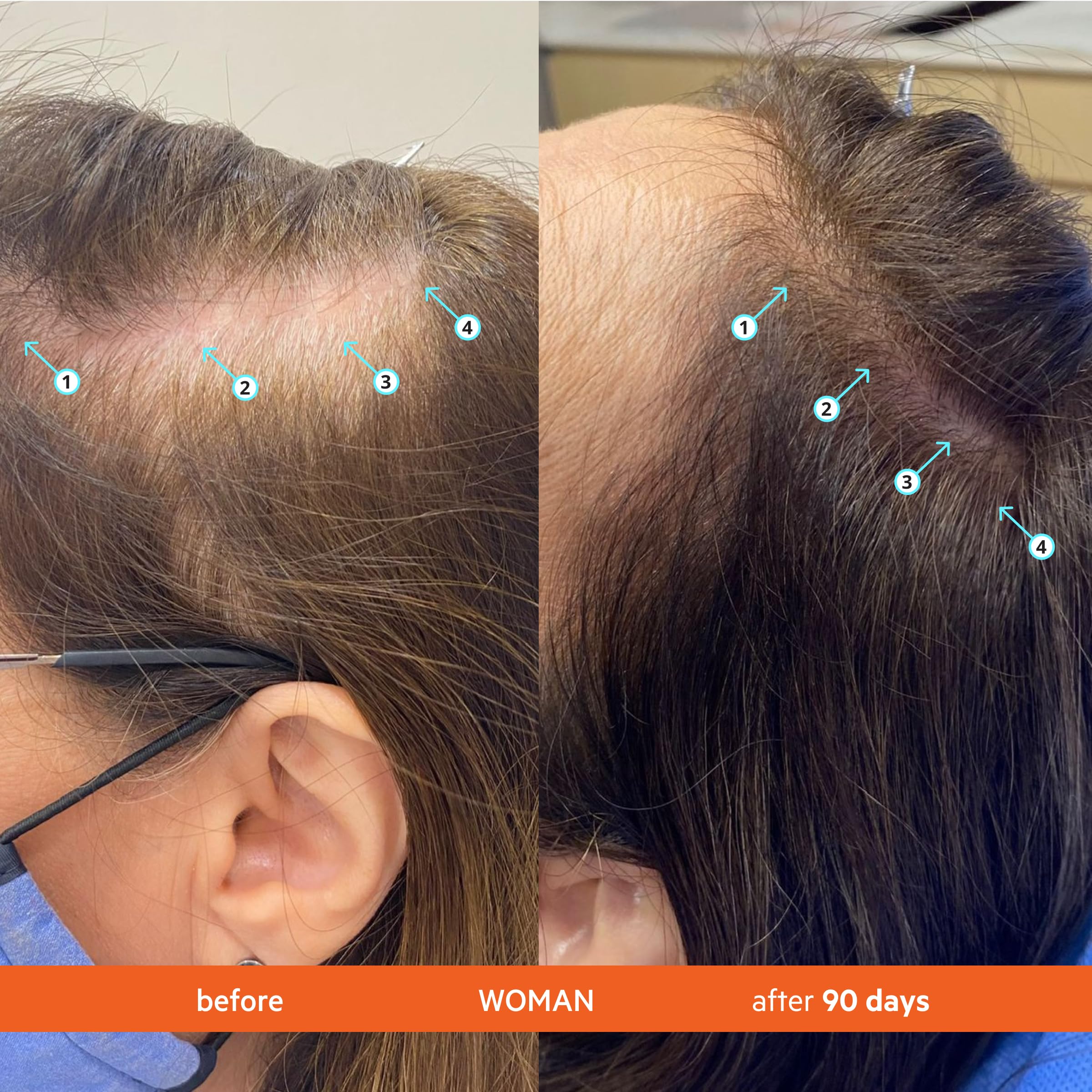 Hair Growth Shampoo & Conditioner Set for Thinning Hair